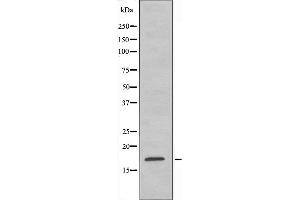 Western blot analysis of extracts from Jurkat cells, using RPS15 antibody. (RPS15 Antikörper  (C-Term))