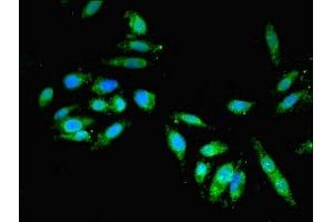 Immunofluorescence (IF) image for anti-Golgi Brefeldin A Resistant Guanine Nucleotide Exchange Factor 1 (GBF1) (AA 1-85) antibody (ABIN7154322)