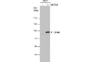 WB Image B-Raf antibody [N2C1], Internal detects B-Raf protein by western blot analysis. (SNRPE Antikörper  (Internal Region))
