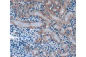 Used in DAB staining on fromalin fixed paraffin- embedded kidney tissue (PLA2G12A Antikörper  (AA 26-192))