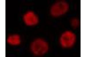 ABIN6274313 staining HT29 cells by IF/ICC. (MEF2B Antikörper  (Internal Region))