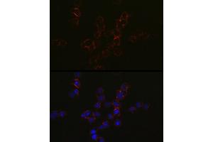 Immunofluorescence analysis of Jurkat cells using CCR5 Rabbit pAb (ABIN7266307) at dilution of 1:50 (40x lens). (CCR5 Antikörper  (AA 100-200))