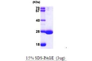 SDS-PAGE (SDS) image for RAP2A, Member of RAS Oncogene Family (RAP2A) (AA 1-180) protein (His tag) (ABIN7279276)