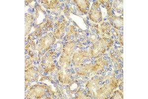 Immunohistochemistry of paraffin-embedded rat kidney using PPP2R2A antibody at dilution of 1:100 (400x lens). (PPP2R2A Antikörper)
