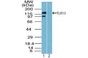 Image no. 1 for anti-Toll-Like Receptor 13 (Tlr13) (AA 800-850) antibody (ABIN960375) (TLR13 Antikörper  (AA 800-850))
