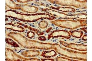 Immunohistochemistry of paraffin-embedded human kidney tissue using ABIN7171209 at dilution of 1:100 (SNCAIP Antikörper  (AA 309-553))
