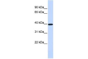 XRCC4 antibody used at 1 ug/ml to detect target protein.