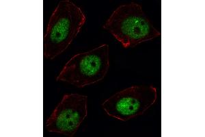 Fluorescent image of U251 cell stained with ARGBP2 Antibody (N-term). (Sorbs2 Antikörper  (N-Term))