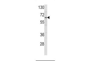 Western blot analysis of ENTH Antibody (Center) (ABIN390833 and ABIN2841059) in HL-60 cell line lysates (35 μg/lane). (CLINT1 Antikörper  (AA 222-249))