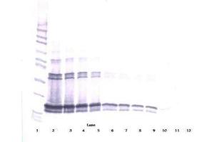 Image no. 1 for anti-Tumor Necrosis Factor (Ligand) Superfamily, Member 13b (TNFSF13B) antibody (ABIN465049) (BAFF Antikörper)