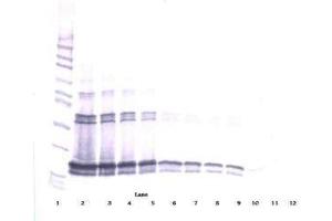 Image no. 1 for anti-Tumor Necrosis Factor (Ligand) Superfamily, Member 13b (TNFSF13B) antibody (ABIN465048) (BAFF Antikörper)