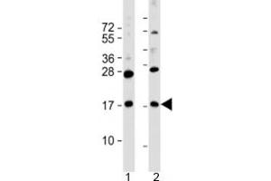 Western blot testing of human 1) MKN45 and 2) PANC-1 cell lysate with FAM159B antibody at 1:2000. (FAM159B Antikörper  (AA 121-154))