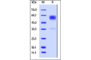Cynomolgus TIM-3, Fc Tag on  under reducing (R) condition. (TIM3 Protein (AA 22-201) (Fc Tag))
