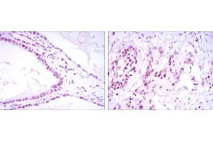 Immunohistochemical analysis of paraffin-embedded kidney convoluted tubule tissues (left) and esophageal cancer tissues (right) using SUZ12 mouse mAb with DAB staining.