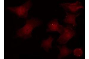 ABIN6276816 staining HeLa by IF/ICC. (POU2F1 Antikörper  (Internal Region))