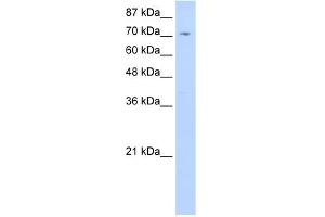 WB Suggested Anti-ZNF214 Antibody Titration:  0.
