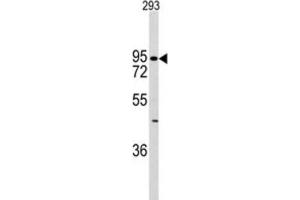 Western Blotting (WB) image for anti-K-Cadherin (CDH6) antibody (ABIN2997777) (CDH6 Antikörper)