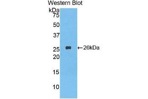 Western blot analysis of the recombinant protein. (LAP Antikörper  (AA 320-519))
