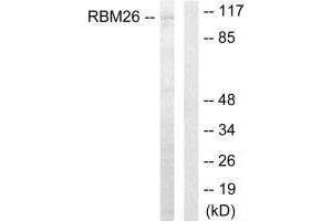 Western blot analysis of extracts from Jurkat cells, using RBM26 antibody. (RBM26 Antikörper  (C-Term))
