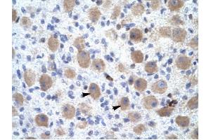 OR13C9 antibody was used for immunohistochemistry at a concentration of 4-8 ug/ml to stain Neural cells (arrows) in Human Brain.