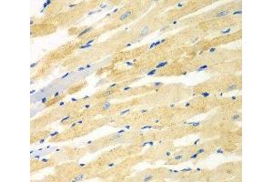 Immunohistochemistry of paraffin-embedded Rat heart using PDE4DIP Polyclonal Antibody at dilution of 1:100 (40x lens). (PDE4DIP Antikörper)