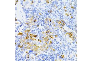 Immunohistochemistry of paraffin-embedded mouse spleen using MMP2 antibody (ABIN5973678) at dilution of 1/100 (40x lens). (MMP2 Antikörper)