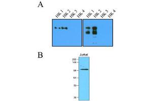 Western Blotting (WB) image for anti-Hexokinase 2 (HK2) (AA 1-917), (N-Term) antibody (ABIN263919) (Hexokinase 2 Antikörper  (N-Term))