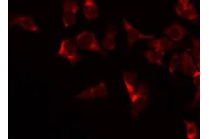 Immunofluorescence (fixed cells) (IF/ICC) image for anti-Cytochrome C Oxidase Subunit IV Isoform 2 (Lung) (COX4I2) (Internal Region) antibody (ABIN6260988)