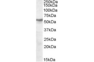Image no. 1 for anti-Nicotinic Acetylcholine Receptor beta (CHRNB1) (Internal Region), (Subunit beta) antibody (ABIN374964) (CHRNB1 Antikörper  (Internal Region, Subunit beta))