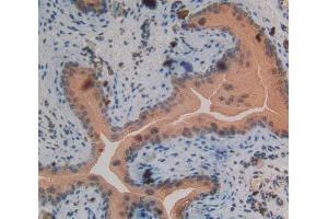 Used in DAB staining on fromalin fixed paraffin- embedded spermaduct tissue