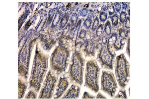 IHC analysis of STUB1 using anti STUB1 antibody (ABIN6719414).