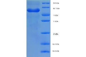 SDS-PAGE (SDS) image for RING1 and YY1 Binding Protein (RYBP) (AA 1-389), (partial) protein (His-SUMO Tag) (ABIN5710852) (RYBP Protein (AA 1-389, partial) (His-SUMO Tag))