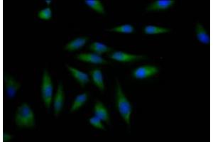 Immunofluorescence staining of Hela Cells with ABIN7127323 at 1:50, counter-stained with DAPI. (Rekombinanter ADAM17 Antikörper)