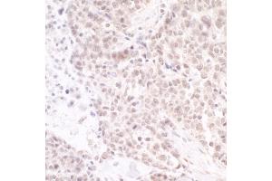 anti-CD3e Molecule, epsilon Associated Protein (CD3EAP) (AA 225-275) antibody