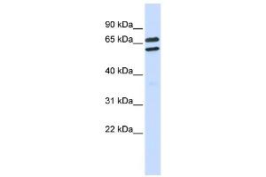 WB Suggested Anti-TRIML1 Antibody Titration:  0. (TRIML1 Antikörper  (Middle Region))
