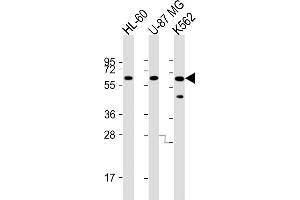 IL1RL2 Antikörper  (AA 257-286)