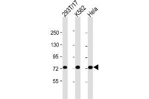 All lanes : Anti-MYBL2 Antibody (C-Term) at 1:2000 dilution Lane 1: 293T/17 whole cell lysate Lane 2: K562 whole cell lysate Lane 3: Hela whole cell lysate Lysates/proteins at 20 μg per lane. (MYBL2 Antikörper  (AA 540-571))
