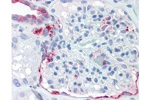 Immunohistochemistry (IHC) image for anti-Solute Carrier Family 39 (Zinc Transporter), Member 14 (SLC39A14) (Internal Region) antibody (ABIN1049336)