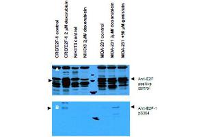 Western blot using E2F1 (phospho S364) polyclonal antibody  shows detection of a band at ~47 kDa corresponding to phospho-E2F1 in induced cell lysates.