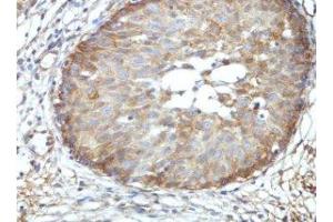 Immunohistochemical staining of formalin-fixed paraffin-embedded fetal urinary bladder showing nuclear staining with BRD9 Antibody at a dilution of 1/100. (BRD9 Antikörper  (AA 264-475))