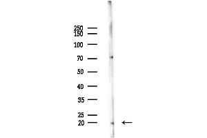 Western blot analysis of lysates from  cells(heat-shock,45 min treatment), using TNFAIP8L2 Antibody at 1/1000 dilution.