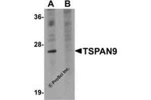 Western blot analysis of TSPAN9 in EL4 cell lysate with this product at 1 μg/ml in (A) the absence and (B) the presence of blocking peptide. (Tetraspanin 9 Antikörper  (Center))