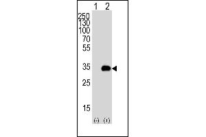 Western blot analysis of G5 (arrow) using rabbit polyclonal G5 Antibody 1812c. (ATG5 Antikörper)