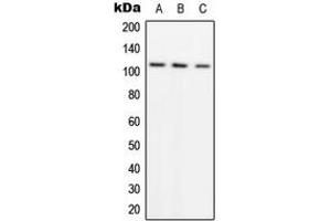 Western blot analysis of ADAMTS1 expression in A549 (A), SW480 (B), HeLa (C) whole cell lysates. (ADAMTS1 Antikörper  (Center))