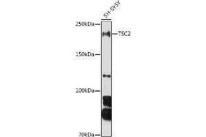 Western blot analysis of extracts of SH-SY5Y cells, using TSC2 antibody (ABIN6128542, ABIN6149611, ABIN6149612 and ABIN6213862) at 1:1000 dilution. (Tuberin Antikörper  (AA 900-1150))