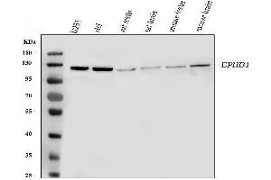 Western blot analysis of Eph receptor B1 using anti-Eph receptor B1 antibody (ABIN3042375). (EPH Receptor B1 Antikörper  (N-Term))