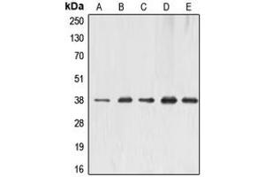 Western blot analysis of ERCC1 expression in MCF7 (A), HeLa (B), A431 (C), mouse liver (D), rat kidney (E) whole cell lysates. (ERCC1 Antikörper  (Center))