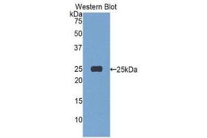 Western Blotting (WB) image for anti-Afamin (AFM) (AA 22-210) antibody (ABIN3205290) (Afamin Antikörper  (AA 22-210))