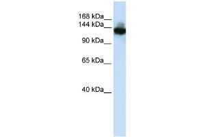 WB Suggested Anti-SCAND3 Antibody Titration:  0. (SCAND3 Antikörper  (C-Term))