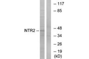 Western blot analysis of extracts from Jurkat cells, using NTR2 Antibody. (NTSR2 Antikörper  (AA 151-200))